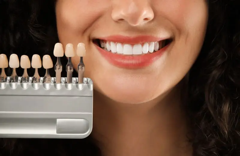 Custom porcelain dental veneers fitted at Recreate Smiles Joondalup WA